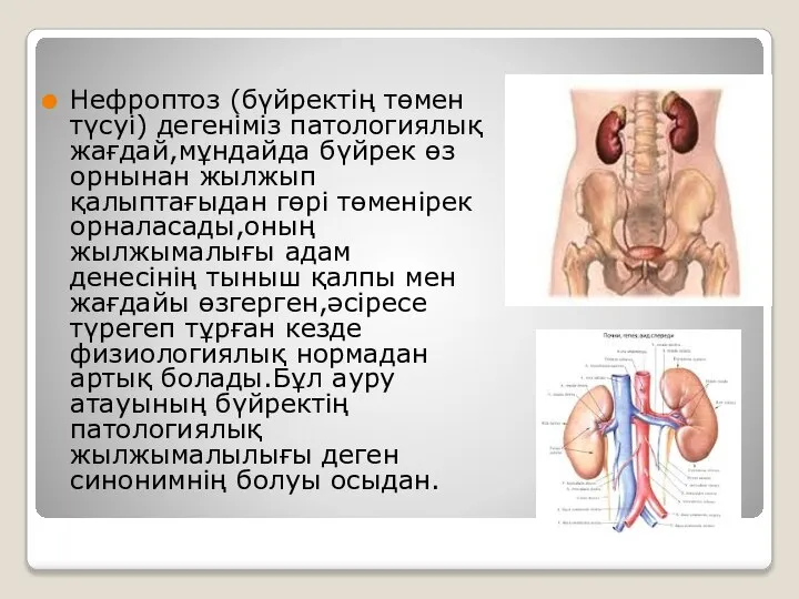 Нефроптоз (бүйректің төмен түсуі) дегеніміз патологиялық жағдай,мұндайда бүйрек өз орнынан жылжып қалыптағыдан