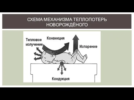 СХЕМА МЕХАНИЗМА ТЕПЛОПОТЕРЬ НОВОРОЖДЁНОГО