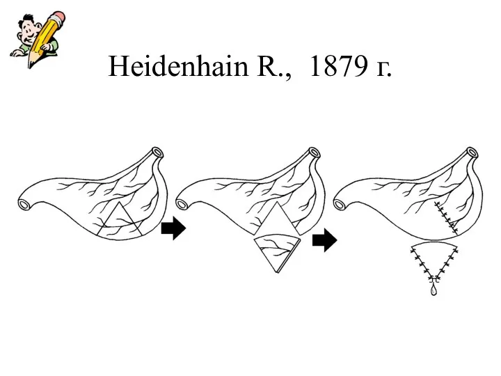 Heidenhain R., 1879 г.