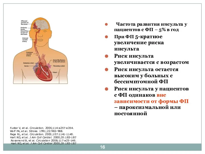 Частота развития инсульта у пациентов с ФП – 5% в год При