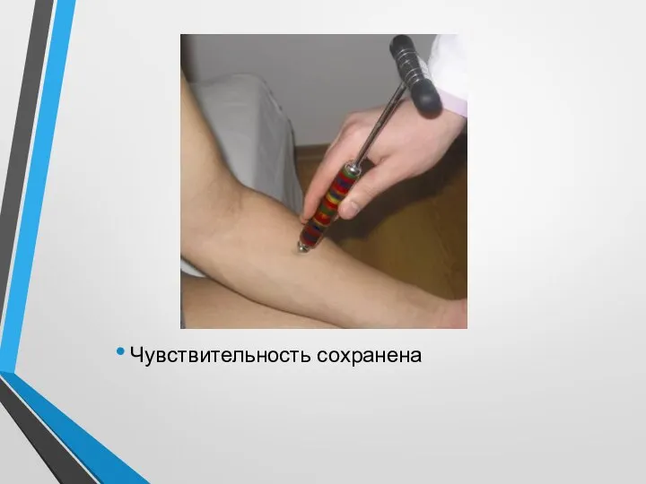 Чувствительность сохранена