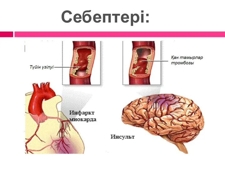 Себептері: