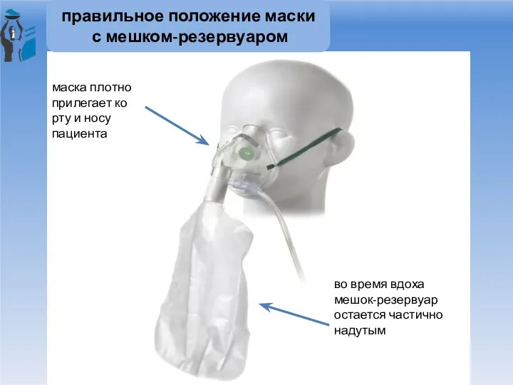 правильное положение маски с мешком-резервуаром маска плотно прилегает ко рту и носу