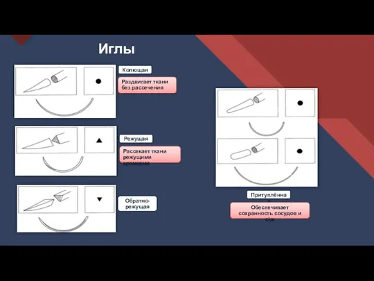 Иглы Колющая Режущая Обратно-режущая Притуплённая Раздвигает ткани без рассечения Рассекает ткани режущими
