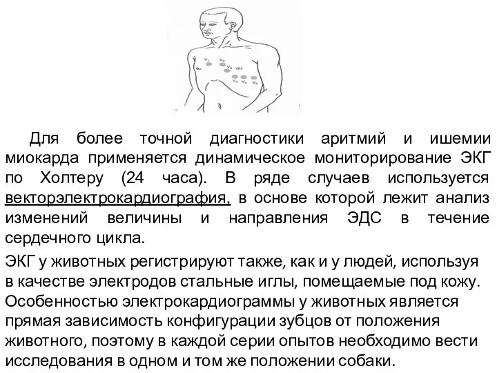 Для более точной диагностики аритмий и ишемии миокарда применяется динамическое мониторирование ЭКГ