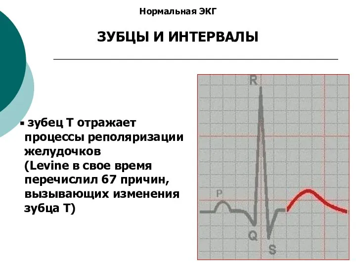 Нормальная ЭКГ ЗУБЦЫ И ИНТЕРВАЛЫ зубец Т отражает процессы реполяризации желудочков (Levine