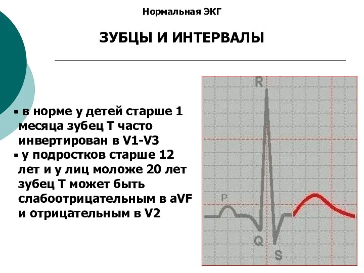 Нормальная ЭКГ ЗУБЦЫ И ИНТЕРВАЛЫ в норме у детей старше 1 месяца