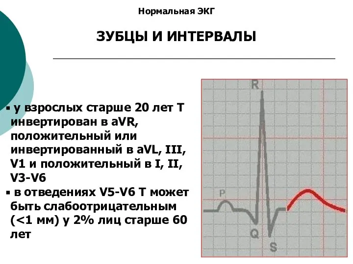 Нормальная ЭКГ ЗУБЦЫ И ИНТЕРВАЛЫ у взрослых старше 20 лет Т инвертирован