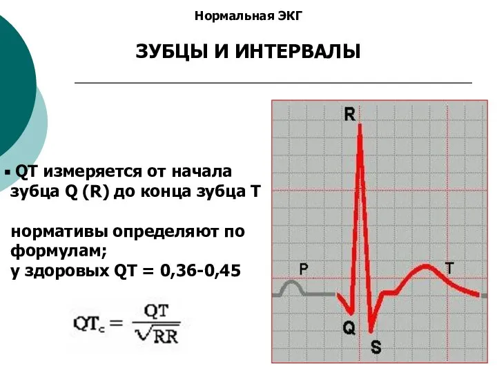 Нормальная ЭКГ ЗУБЦЫ И ИНТЕРВАЛЫ QT измеряется от начала зубца Q (R)