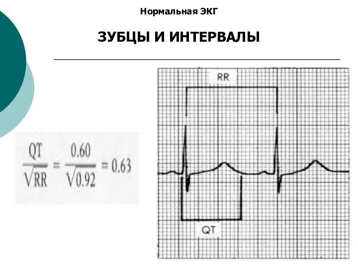 Нормальная ЭКГ ЗУБЦЫ И ИНТЕРВАЛЫ