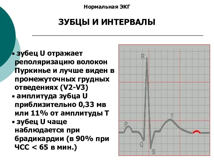 Нормальная ЭКГ ЗУБЦЫ И ИНТЕРВАЛЫ зубец U отражает реполяризацию волокон Пуркинье и