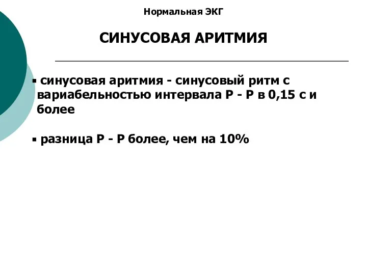 Нормальная ЭКГ СИНУСОВАЯ АРИТМИЯ cинусовая аритмия - синусовый ритм с вариабельностью интервала