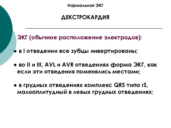 Нормальная ЭКГ ДЕКСТРОКАРДИЯ ЭКГ (обычное расположение электродов): в I отведении все зубцы