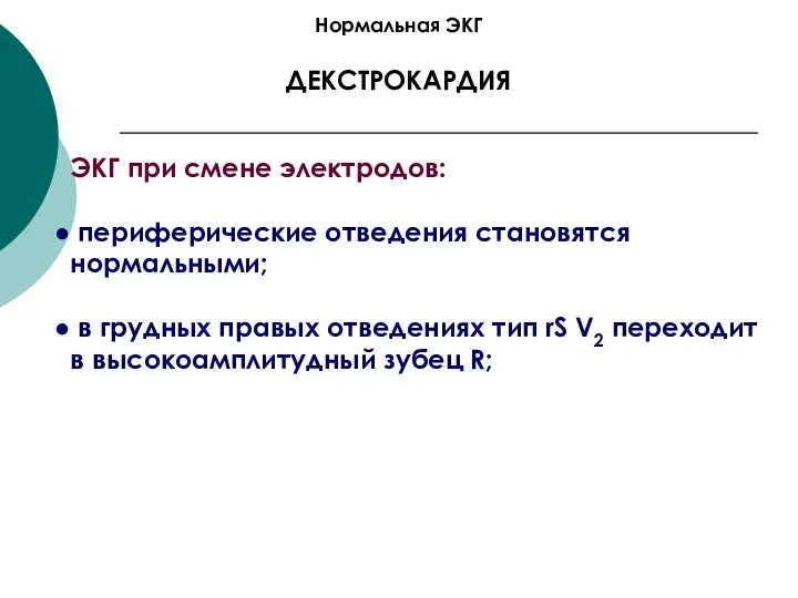 Нормальная ЭКГ ДЕКСТРОКАРДИЯ ЭКГ при смене электродов: периферические отведения становятся нормальными; в