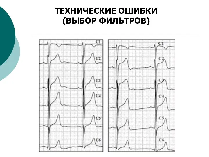 ТЕХНИЧЕСКИЕ ОШИБКИ (ВЫБОР ФИЛЬТРОВ)