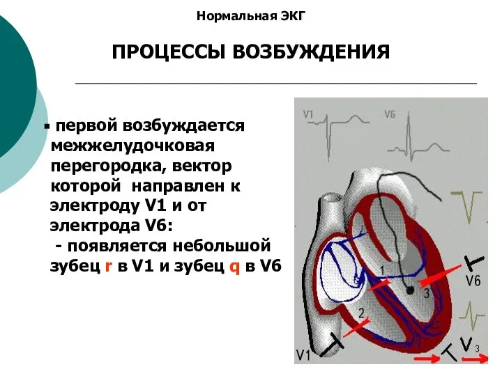 Нормальная ЭКГ ПРОЦЕССЫ ВОЗБУЖДЕНИЯ первой возбуждается межжелудочковая перегородка, вектор которой направлен к