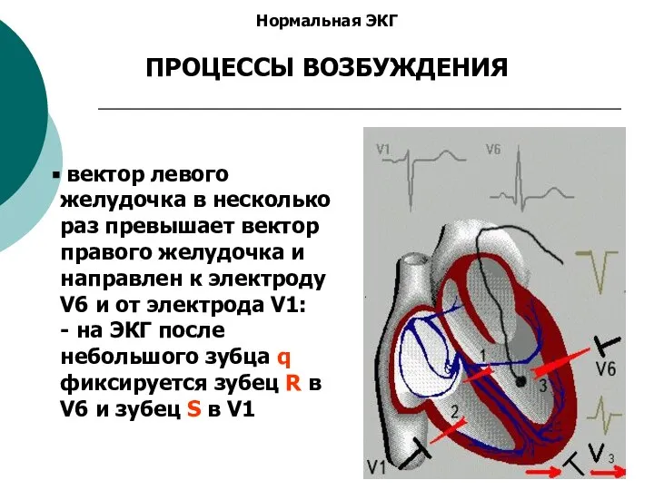 Нормальная ЭКГ ПРОЦЕССЫ ВОЗБУЖДЕНИЯ вектор левого желудочка в несколько раз превышает вектор