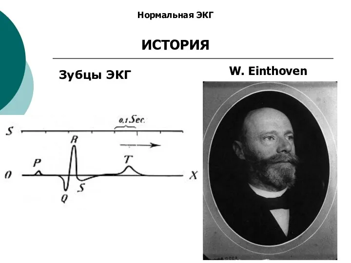 Нормальная ЭКГ ИСТОРИЯ Зубцы ЭКГ W. Einthoven