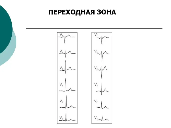 ПЕРЕХОДНАЯ ЗОНА