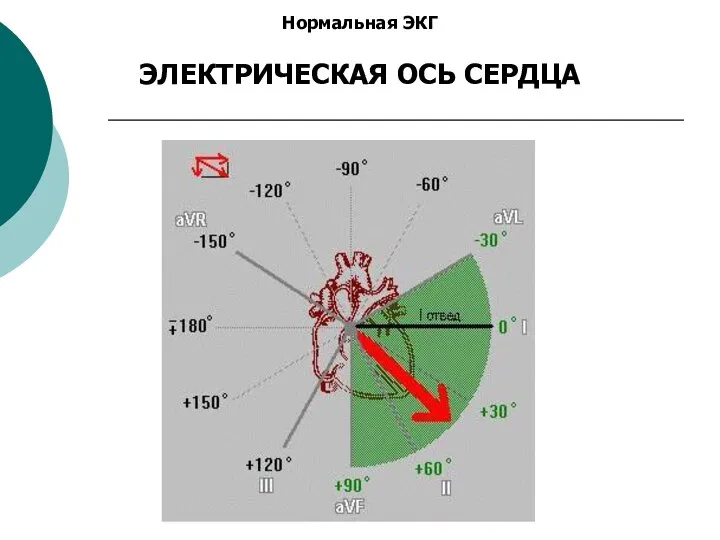 Нормальная ЭКГ ЭЛЕКТРИЧЕСКАЯ ОСЬ СЕРДЦА