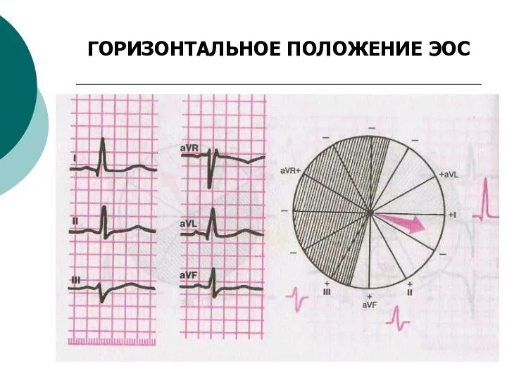 ГОРИЗОНТАЛЬНОЕ ПОЛОЖЕНИЕ ЭОС