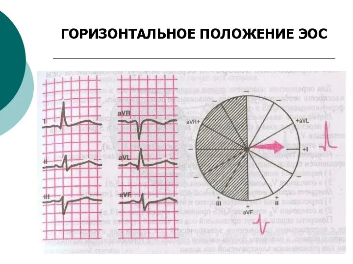 ГОРИЗОНТАЛЬНОЕ ПОЛОЖЕНИЕ ЭОС