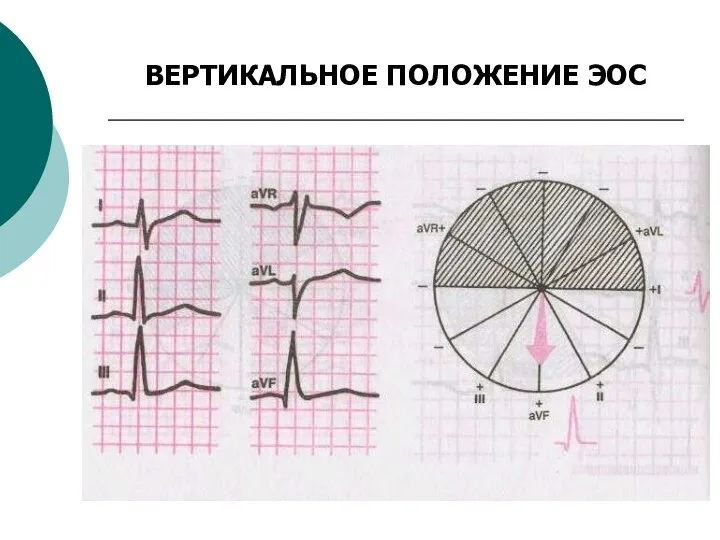 ВЕРТИКАЛЬНОЕ ПОЛОЖЕНИЕ ЭОС