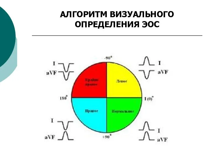 АЛГОРИТМ ВИЗУАЛЬНОГО ОПРЕДЕЛЕНИЯ ЭОС