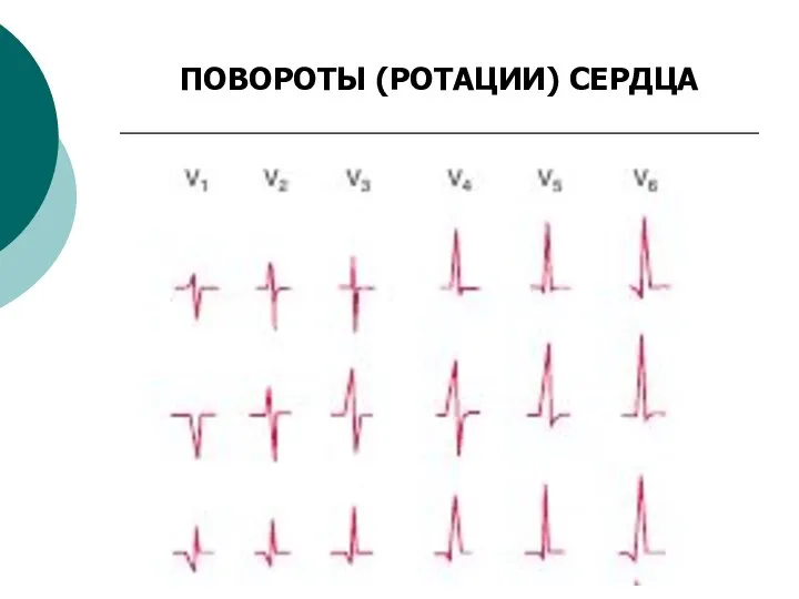 ПОВОРОТЫ (РОТАЦИИ) СЕРДЦА