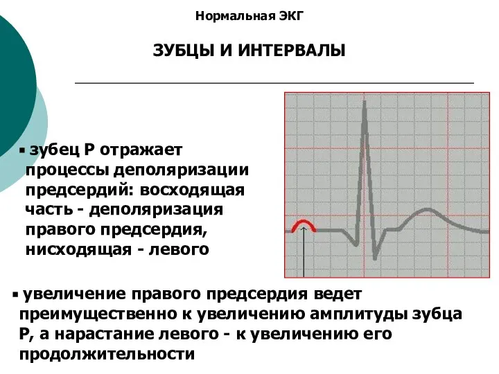 Нормальная ЭКГ ЗУБЦЫ И ИНТЕРВАЛЫ зубец P отражает процессы деполяризации предсердий: восходящая