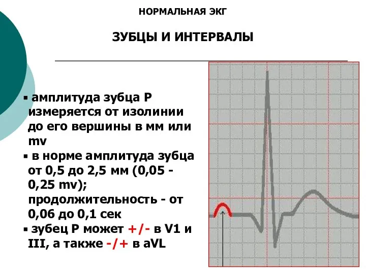 НОРМАЛЬНАЯ ЭКГ ЗУБЦЫ И ИНТЕРВАЛЫ амплитуда зубца P измеряется от изолинии до