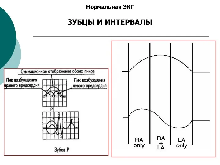 Нормальная ЭКГ ЗУБЦЫ И ИНТЕРВАЛЫ