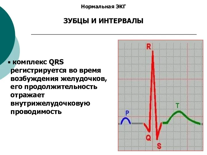 Нормальная ЭКГ ЗУБЦЫ И ИНТЕРВАЛЫ комплекс QRS регистрируется во время возбуждения желудочков,