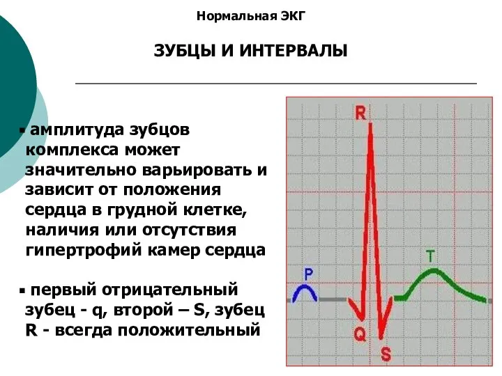 Нормальная ЭКГ ЗУБЦЫ И ИНТЕРВАЛЫ амплитуда зубцов комплекса может значительно варьировать и