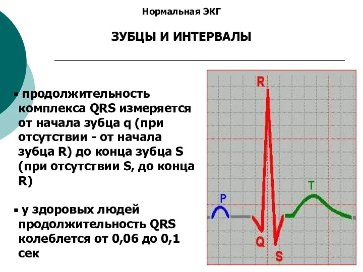 Нормальная ЭКГ ЗУБЦЫ И ИНТЕРВАЛЫ продолжительность комплекса QRS измеряется от начала зубца