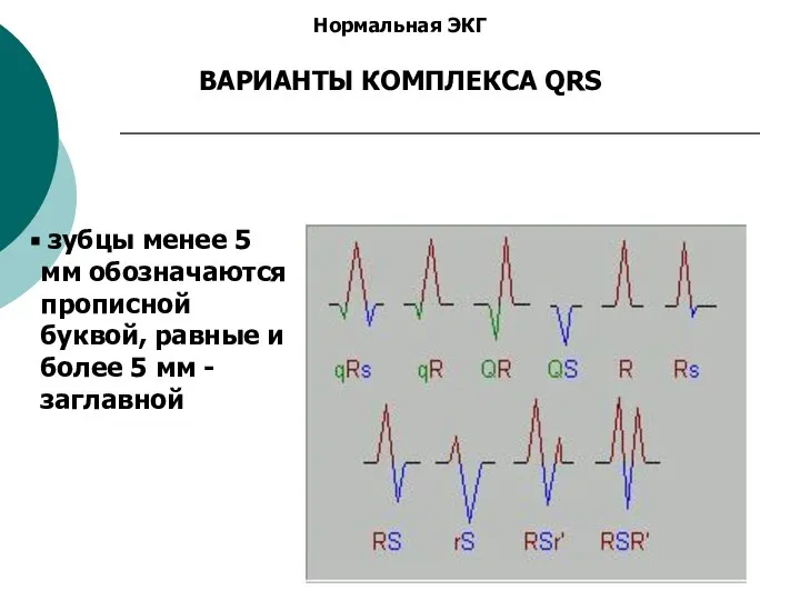 Нормальная ЭКГ ВАРИАНТЫ КОМПЛЕКСА QRS зубцы менее 5 мм обозначаются прописной буквой,