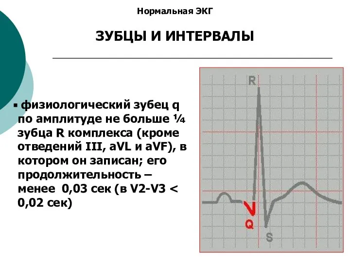 Нормальная ЭКГ ЗУБЦЫ И ИНТЕРВАЛЫ физиологический зубец q по амплитуде не больше