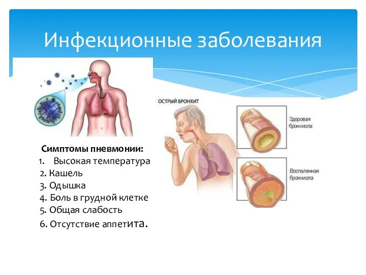 Инфекционные заболевания Симптомы пневмонии: Высокая температура 2. Кашель 3. Одышка 4. Боль