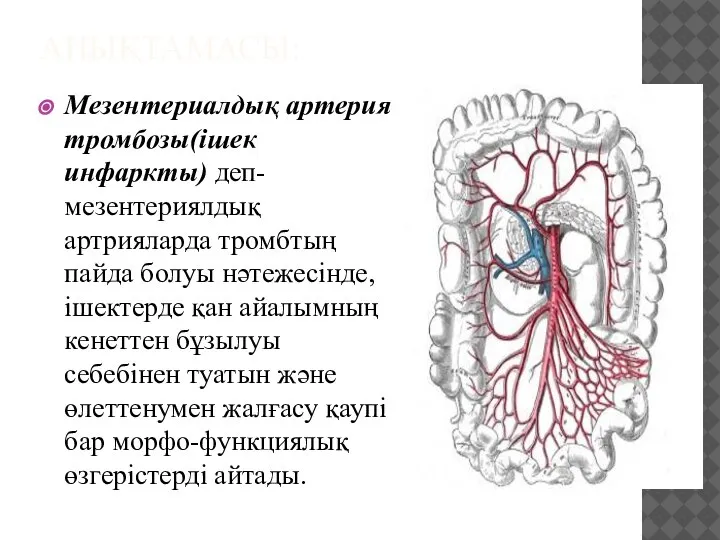 АНЫҚТАМАСЫ: Мезентериалдық артерия тромбозы(ішек инфаркты) деп-мезентериялдық артрияларда тромбтың пайда болуы нәтежесінде, ішектерде