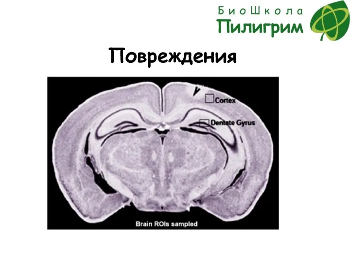 Повреждения