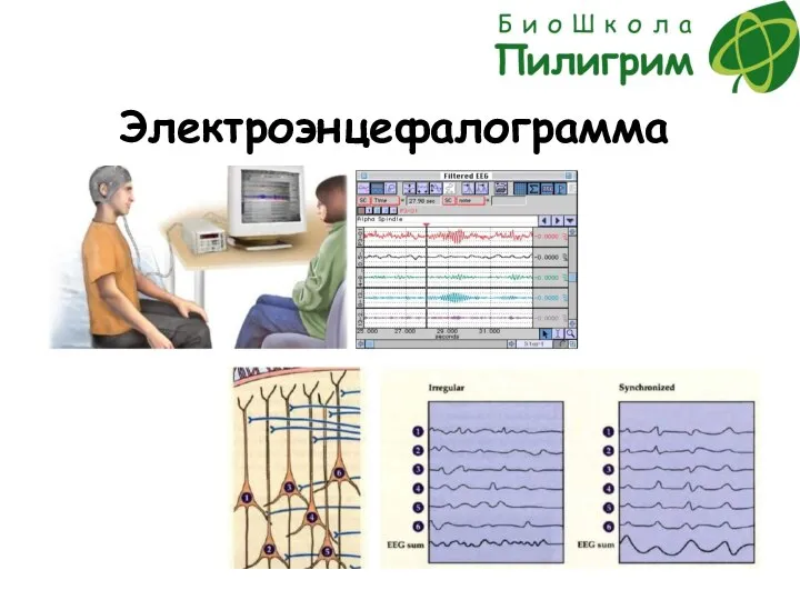 Электроэнцефалограмма