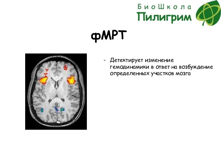 фМРТ Детектирует изменение гемодинамики в ответ на возбуждение определенных участков мозга