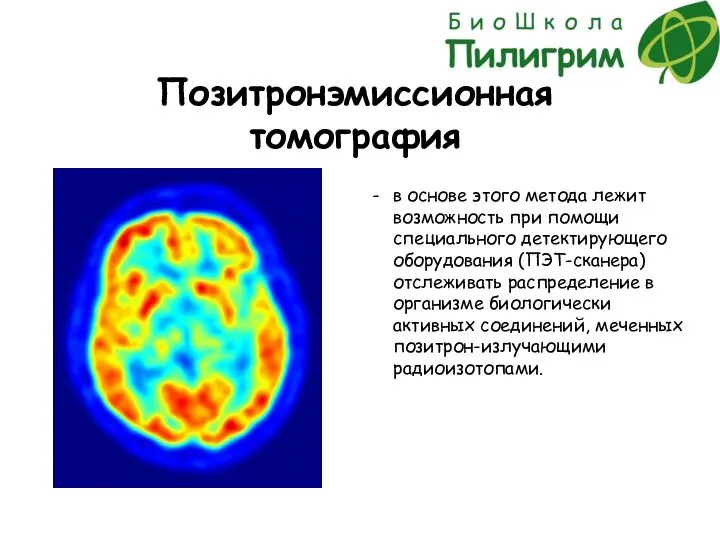 Позитронэмиссионная томография в основе этого метода лежит возможность при помощи специального детектирующего