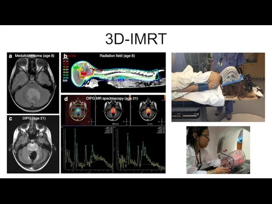 3D-IMRT