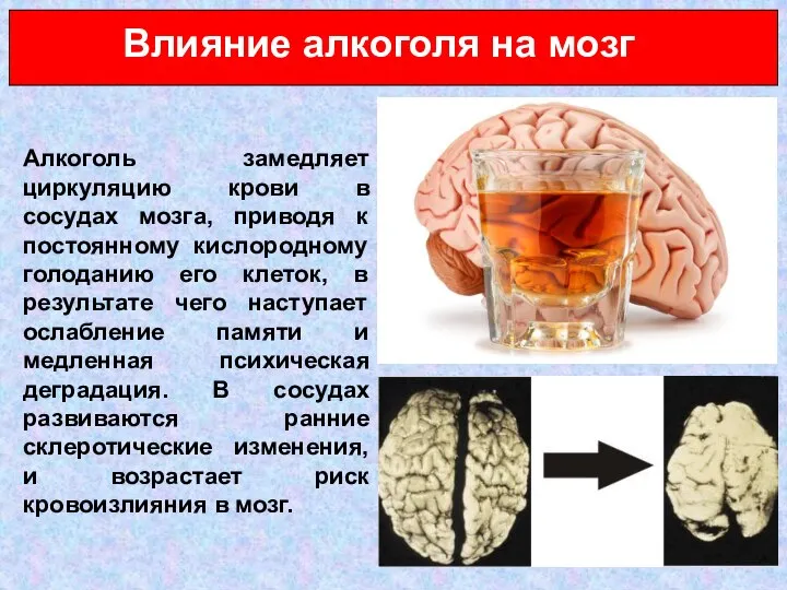 Влияние алкоголя на мозг Алкоголь замедляет циркуляцию крови в сосудах мозга, приводя