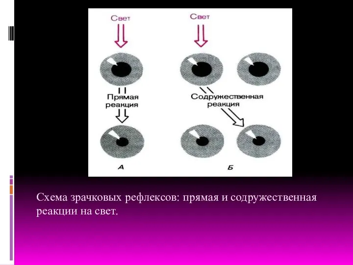 Схема зрачковых рефлексов: прямая и содружественная реакции на свет.