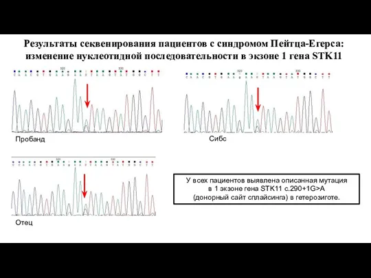 Результаты секвенирования пациентов с синдромом Пейтца-Егерса: изменение нуклеотидной последовательности в экзоне 1