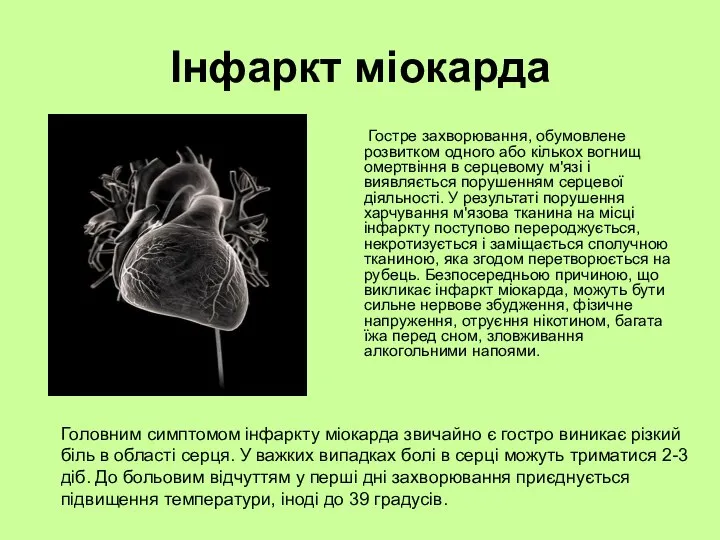 Інфаркт міокарда Гостре захворювання, обумовлене розвитком одного або кількох вогнищ омертвіння в