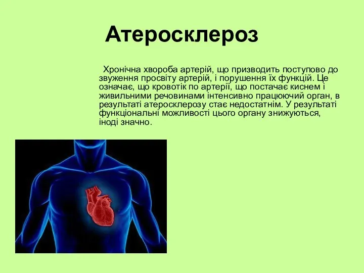 Атеросклероз Хронічна хвороба артерій, що призводить поступово до звуження просвіту артерій, і