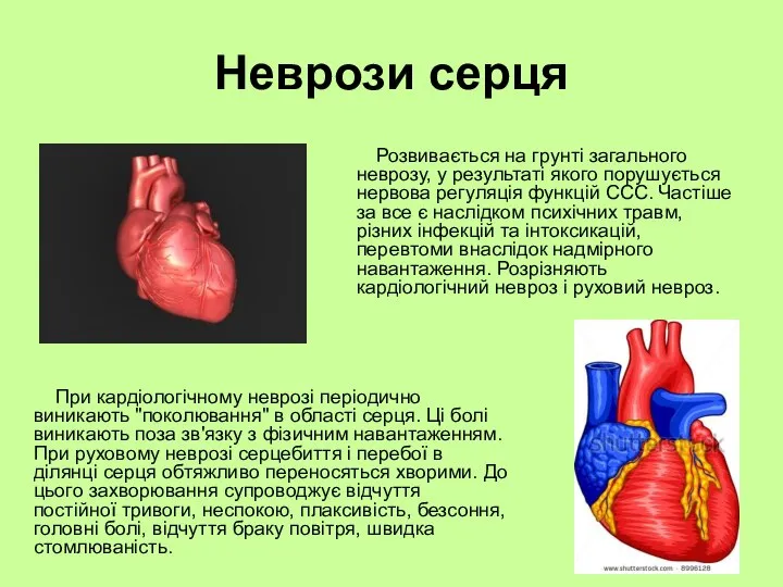 Неврози серця Розвивається на грунті загального неврозу, у результаті якого порушується нервова